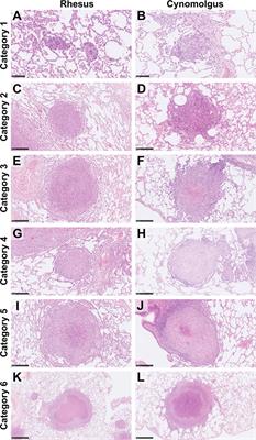 Dynamics of Macrophage, T and B Cell Infiltration Within Pulmonary Granulomas Induced by Mycobacterium tuberculosis in Two Non-Human Primate Models of Aerosol Infection